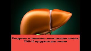 Тревожные звоночки интоксикации печени Лучшие продукты для печени [upl. by Aillicirp]