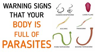 Dont Ignore These Early Symptoms Of Parasites In Your Body [upl. by Assetal224]