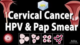 Cervical Cancer HPV and Pap Test Animation [upl. by Nageet324]