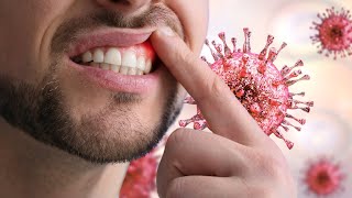 SDLE microorganisms منال نوتز saudi dental licensure examination [upl. by Perkoff]