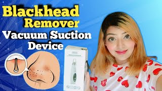 How To Use Blackhead Vacuum Suction Machine  blackhead pore vacuum  Does it Work [upl. by Hadnama849]