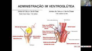 Aplicação de Injeção  Modulo 8 – IM – VentrogluteaAdministração Intramuscular Ventroglútea [upl. by Hafeenah]