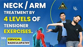 NECK  ARM PAIN TREATMENT BY 4 LEVELS OF TENSIONER EXERCISES  NEURODYNAMICS TREATMENT APPROACH [upl. by Regan26]