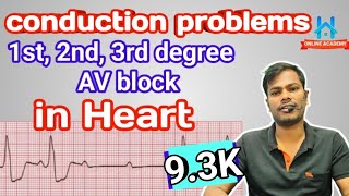 av block ecg  1st degree av block  2nd degree AV block  complete heart block  CHB ecg [upl. by Juni]