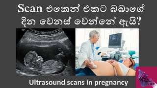 Scan එකෙන් එකට බබාගේ දින වෙනස් වෙන්නේ ඇයි [upl. by Laurin]