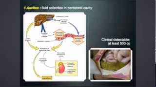 Disease of hepatobiliary system gallbladder and exocrine pancreas Part 1 [upl. by Mcmullan]