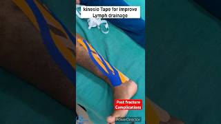 Kinesio taping for improve lymphatic drainage How to reduce edema kinesiotape kinesiotherapy [upl. by Enilegna499]