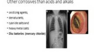 كلية التمريض الفرقه الثالثه ماده الطب الشرعى محاضرة د ابراهيم بعنوان corrosives بتاريخ 253 [upl. by Kerri]