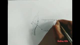 megasporophyll of cycas  how to draw megasporophyll of cycas  megasporophyll angiosperms [upl. by Yelnahs]