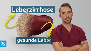 Leberzirrhose verstehen Ursachen Symptome Diagnose amp Therapie  DocTommy [upl. by Hibben]