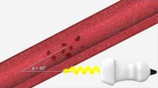 Ultrasound Physics  Explaining Doppler [upl. by Poler687]