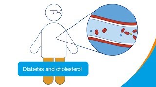 Diabetes and cholesterol  How it works  Diabetes UK [upl. by Meredeth]