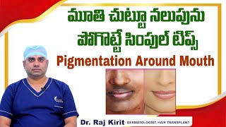 మూతి చుట్టూ నలుపు  How to Get Rid of Pigmentation Around Mouth  Celestee Skin And Hair Clinic [upl. by Marlane993]