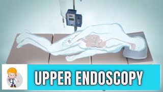 Upper GI endoscopy Esophagogastroduodenoscopy Animation 3D [upl. by Tloc]