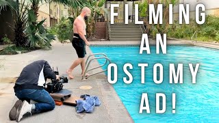 Making a POSITIVE Ad about People with Ostomy Bags [upl. by Ecinej]