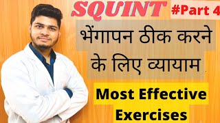 भेंगापन ठीक करने के लिए व्यायाम  Exercises to Cure Squint Treatment of Squint by these 4 exercises [upl. by Anerak425]