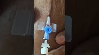 IV cannula insertiondoctertrendingforyoushortvideoviralvideo [upl. by Arannahs]