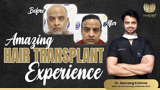 Amazing Hair Transplant Journey  Best Hair Transplant Result  MedLinks [upl. by Maidel]