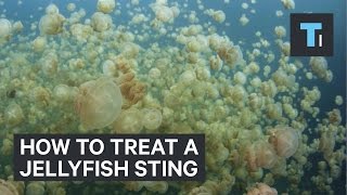 How to treat a jellyfish sting [upl. by Hilel680]