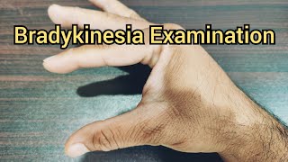 How to Examine a Patient for Bradykinesia  Parkinsonism [upl. by Epstein772]