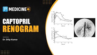 Captopril Renogram Medicine  Dr Dilip Kumar [upl. by Corrianne]