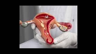 fallopian tube in female ka most important video hai [upl. by Enilrem]