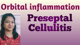 Preseptal cellulitis Orbital inflammation Orbit Ophthalmology Optometry Orbital cellulitis [upl. by Naitsyrk183]