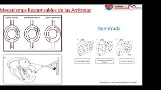 12  Extrasístoles auriculares y ventriculares [upl. by Babcock]