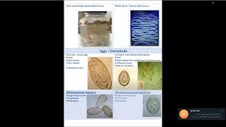 Revision of Practical Medical Parasitology  DrMahomoud Yousef [upl. by Aicilas]