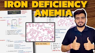 Iron Deficiency Anemia  Hematology  Pathology [upl. by Ahtaga175]