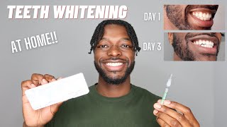 MY TEETH WHITENING ROUTINE AT HOME  OPALESCENCE TEETH WHITENING [upl. by Eirhtug]