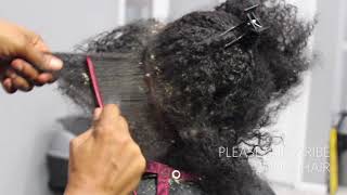 Picking BIG scalp flakes Psoriasis and Dermatitis SEW IN WEAVE REMOVAL [upl. by Earvin]