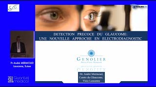 SFO 2017 – Détection précoce du glaucome  une nouvelle approche en électrodiagnostic [upl. by Dillon]