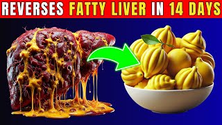 Naturally Reverse Fatty Liver in Just 14 Days – It’s Easier Than You Think Healthy Care [upl. by Jeggar]