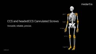 Medartis CCS headedCCS Cannulated Screws Trailer 2024 [upl. by Carter39]