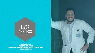 LIVER ABSCESS  PYOGENIC amp AMEBIC LIVER ABSCESS APPROACH AND TREATMENT شرح خراج الكبد لطلبه الطب [upl. by Alasteir]