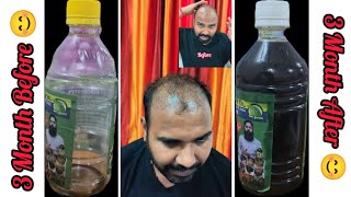 How To Use Adivasi Hair OilHow To Apply Adivasi Oil3 Month After Review part3 adivasi oil vlog [upl. by Aidahs]