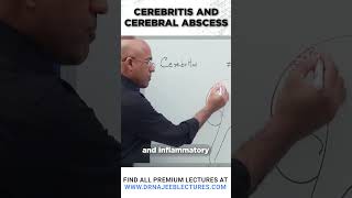 Cerebritis And Cerebral Abscess drnajeeb drnajeeblectures shortvideostatus [upl. by Germano829]