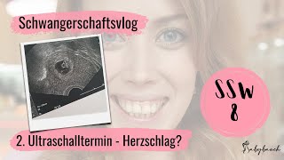 SSW 8  2Ultraschalltermin  Schlägt das Herz  Schwangerschaftsvlog Schwangerschaftswoche 8 [upl. by Esoj]