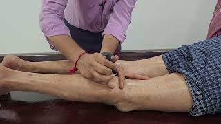 Moxibustion Therapy Learn from Experts in the Field DrShashikant Moxibustion Acupuncture imwell [upl. by Acinna]