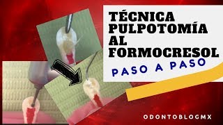 Técnica PULPOTOMÍA AL FORMOCRESOL  paso a paso [upl. by Aynotahs]