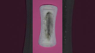 Why Is My Discharge Grey Could It Be Bacterial Vaginosis BV [upl. by Navets]