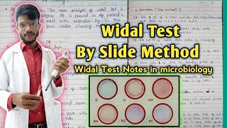 Widal test by Slide Method in hindiwidal test notes in microbiology widaltest [upl. by Neibaf]