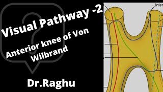 Visual Pathway 2  Von Wilbrand Knee and its lesion  Junctional Scotoma [upl. by Allcot383]