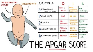 APGAR Score Made Easy  Newborn Assessment APGAR Mnemonic [upl. by Nylarak]