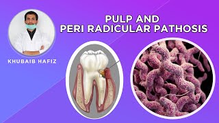 Pulp and Periradicular pathosis [upl. by Dagny]