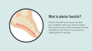 Plantar Fasciitis Causes Symptoms and Treatment  Merck Manual Consumer Version [upl. by Henrietta]