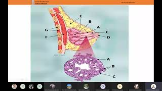 Práctica 12 Dra Zumaeta Parte 1 Carcinoma ductal infiltrante de mama y Adenocarcinoma infiltrante [upl. by Atazroglam]