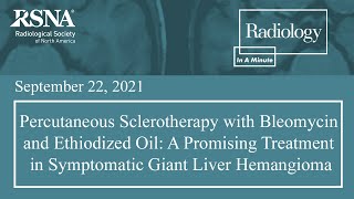 A Promising Treatment in Symptomatic Giant Liver Hemangioma [upl. by Stag]