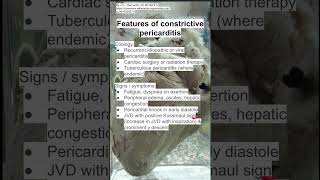 Features of constrictive pericarditis [upl. by Aiuqcaj]